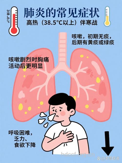 典型肺炎有什么症状呢