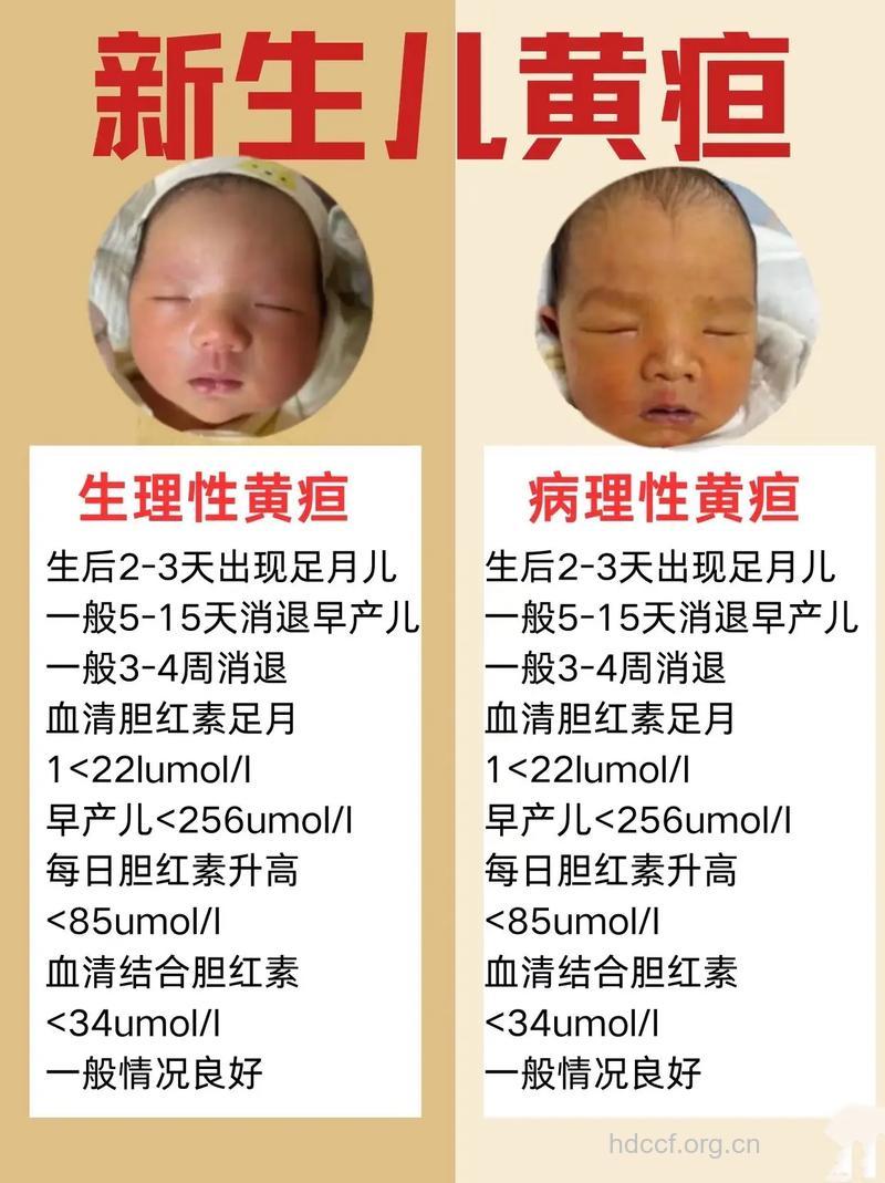 新生儿黄疸有什么症状呢