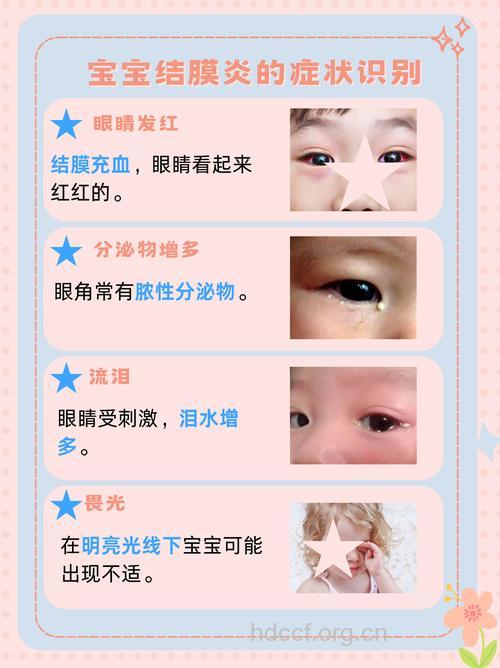 夏季红眼病高发 宝宝患上红眼病怎么办