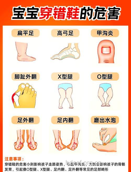 小孩子爱穿皮鞋会不会影响发育？