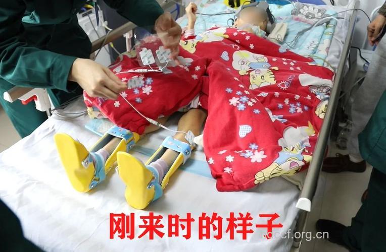 2岁儿童打完疫苗成植物人