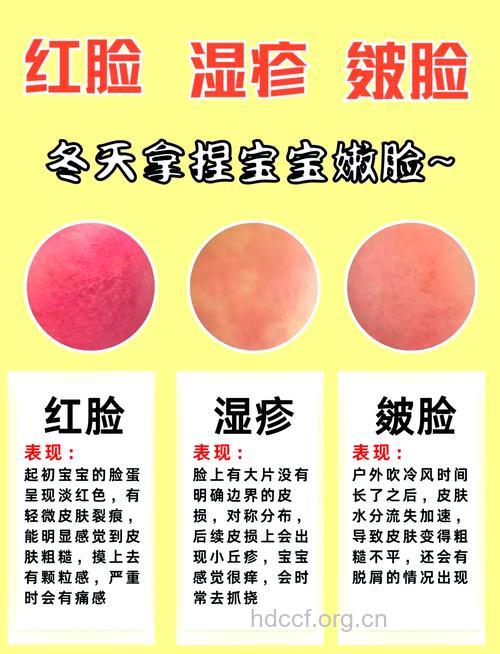 宝宝面红应怎么办