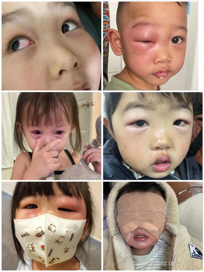 宝宝过早又长期使用IPAD有什么危害