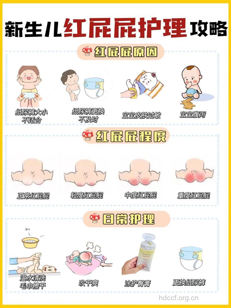 解决新生儿红屁股安全又方便的方法