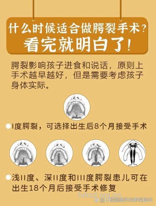 小儿唇裂什么时候做手术合适?