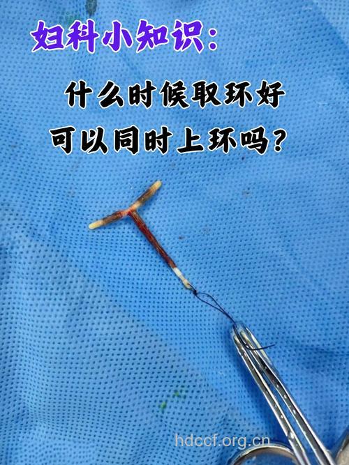 上节育环避孕效果怎么样