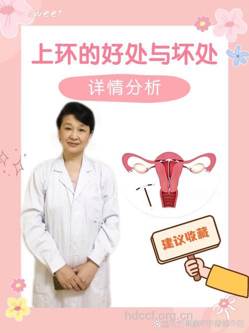 已婚女性上环节育好吗