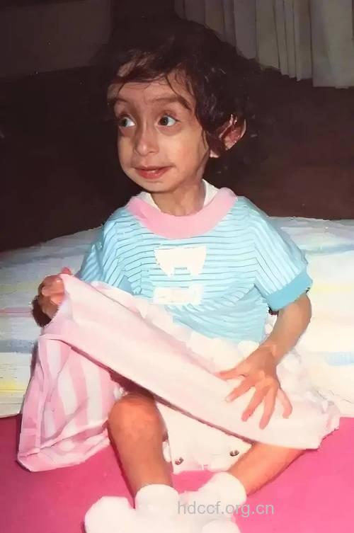 浓妆艳抹 6种女人易生畸形儿