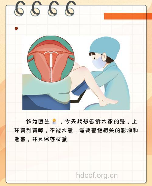 上环会不会伤害女性子宫