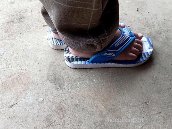 小宝宝穿拖鞋 阻碍身体发育