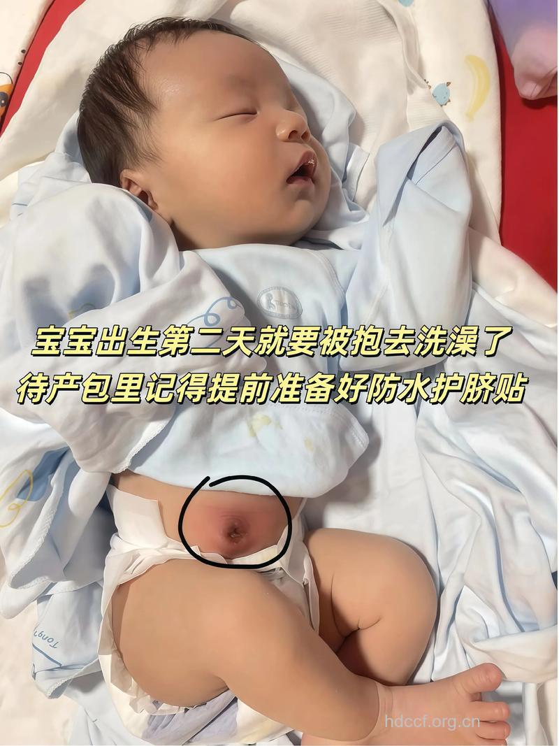 小宝宝肚脐进水如何解决?