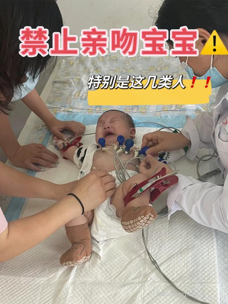 勿亲吻刚出生宝宝的几类人