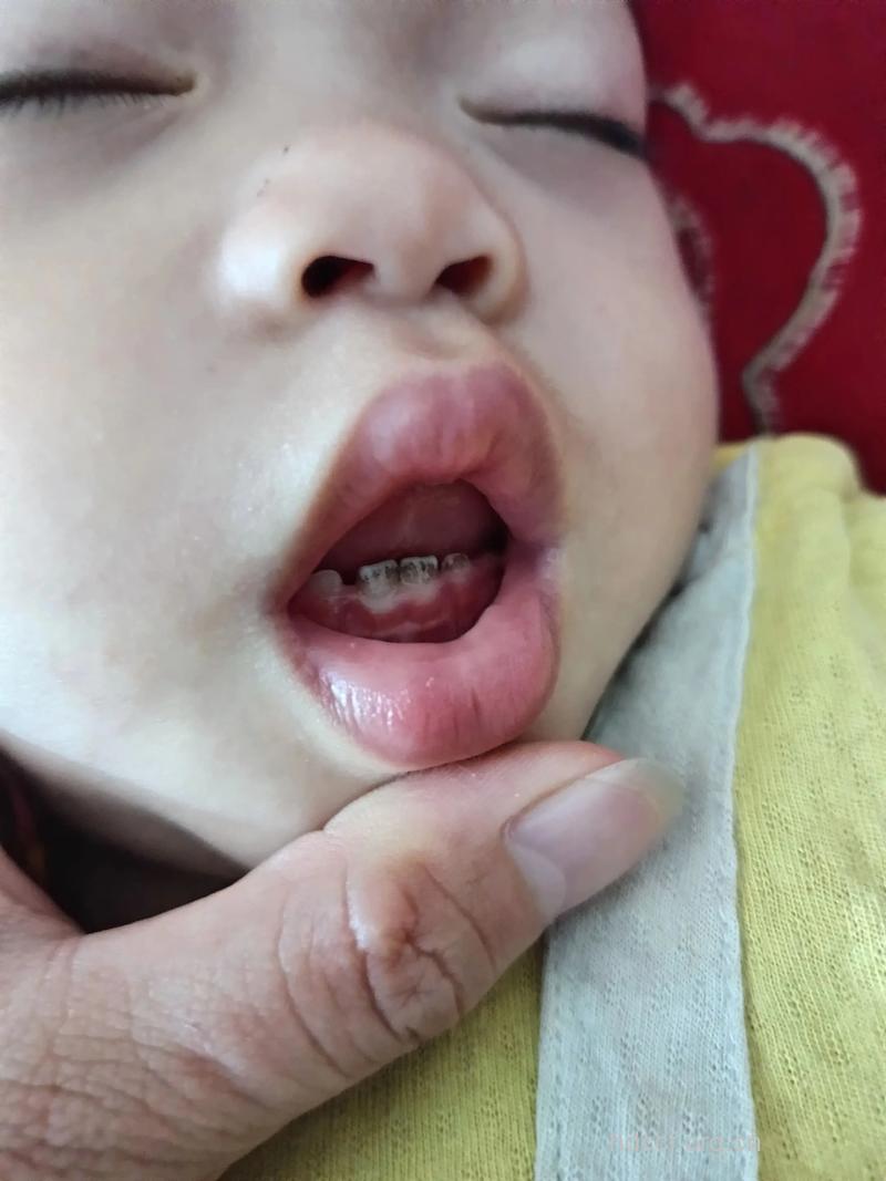 小宝宝乳牙又黑又黄如何是好?