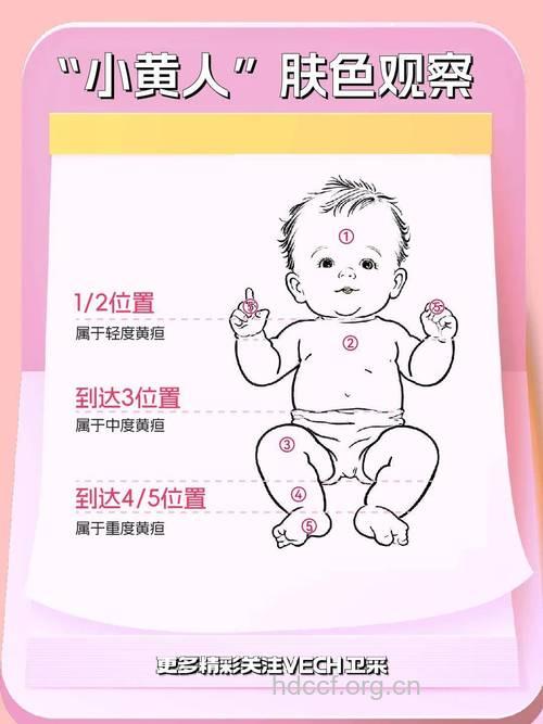 新生儿黄疸要做哪一些检查