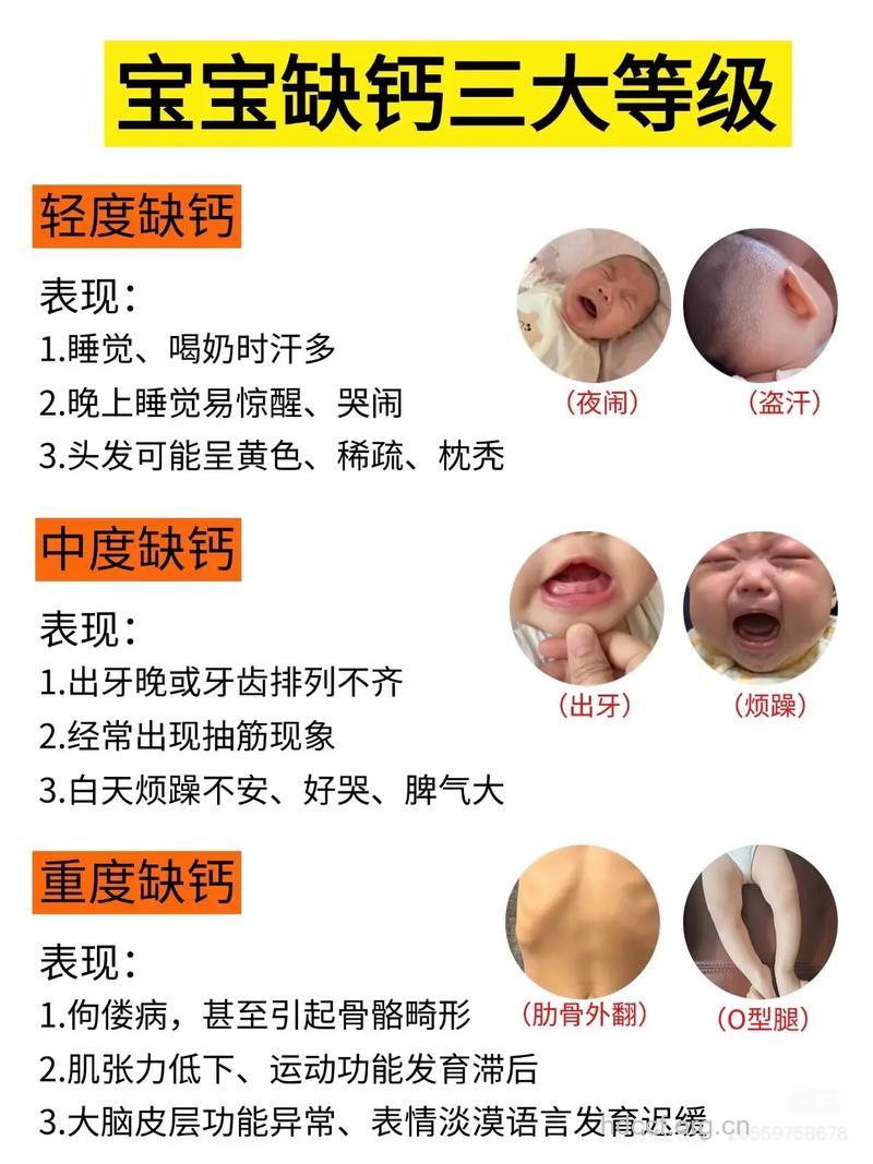 怎样发现孩子缺钙?