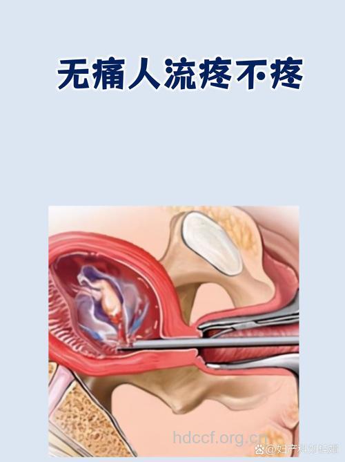 无痛人流到底会不会痛?