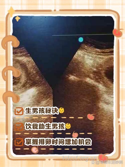 怎么样生男孩的机率比较大 做到以下5点即可