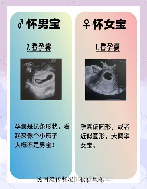 胎儿性别预测 孕囊形状看男女准吗