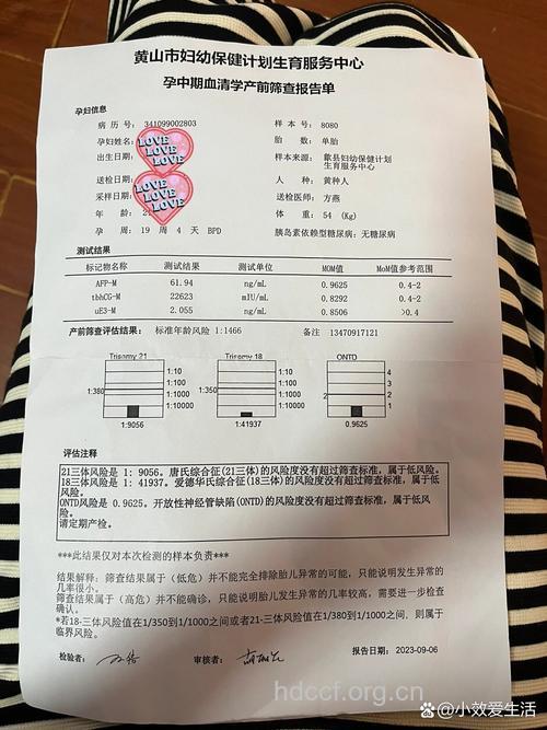 唐氏筛查结果看出胎儿性别