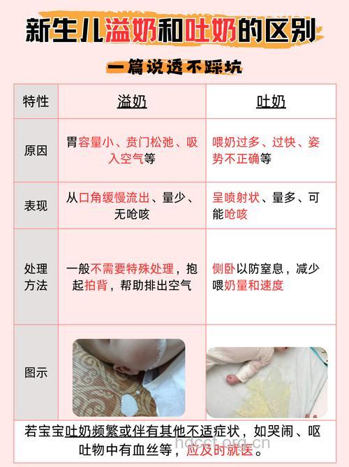 新生儿溢奶与呕吐到底怎么区别