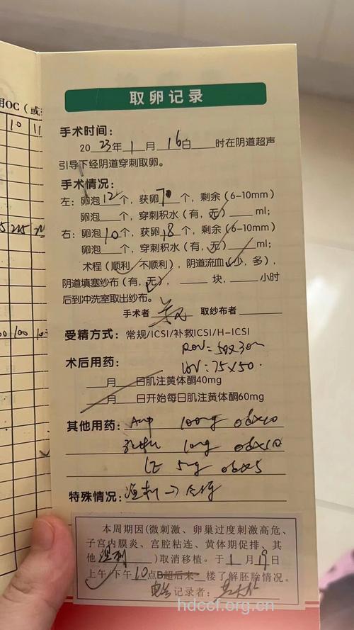 卵泡穿刺术 卵泡穿刺费用具体是多少