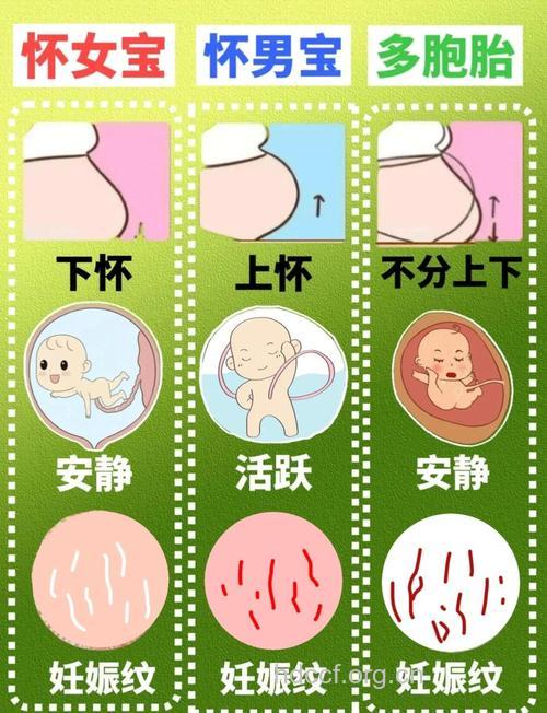 妊娠纹能看出胎儿的性别吗