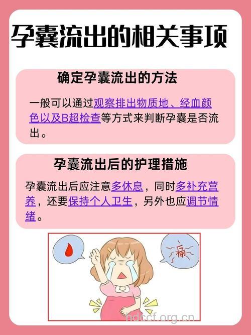 药物流产 应注意观察孕囊是否排出