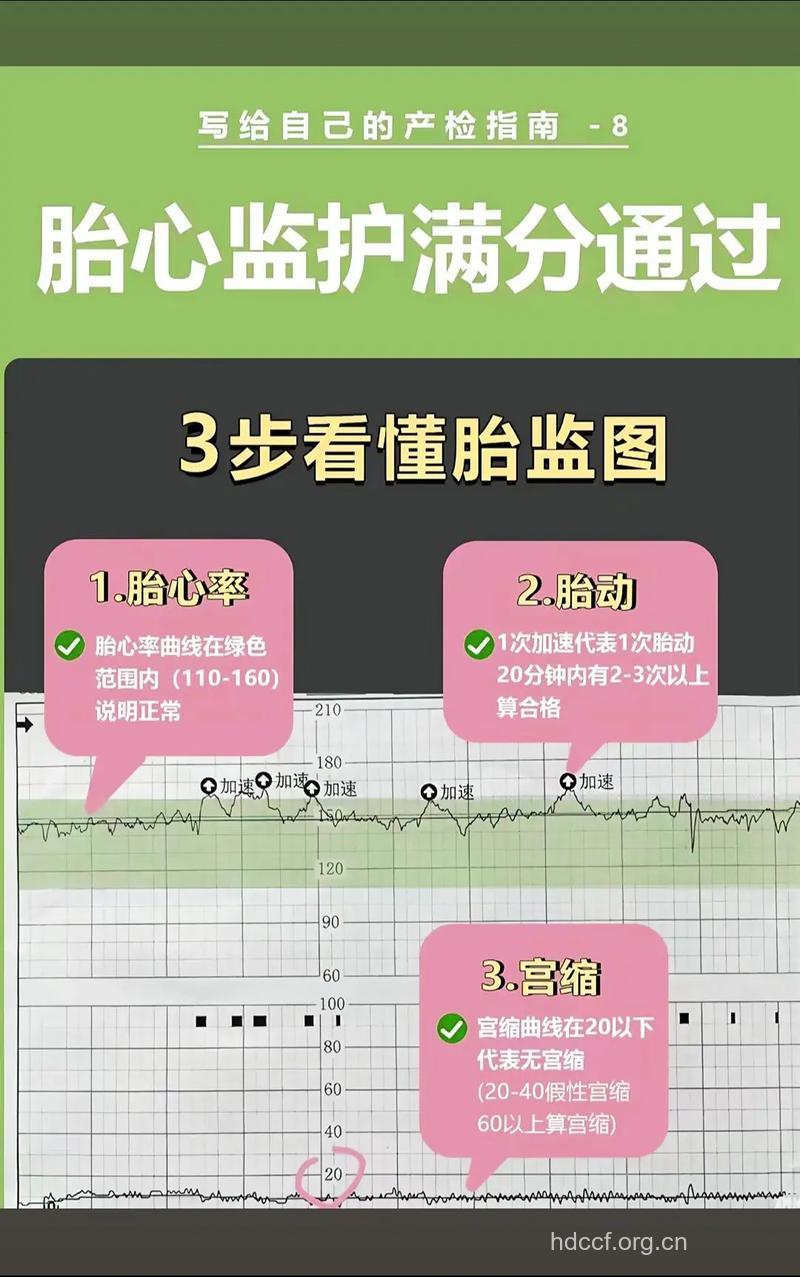 胎心监护看生男生女