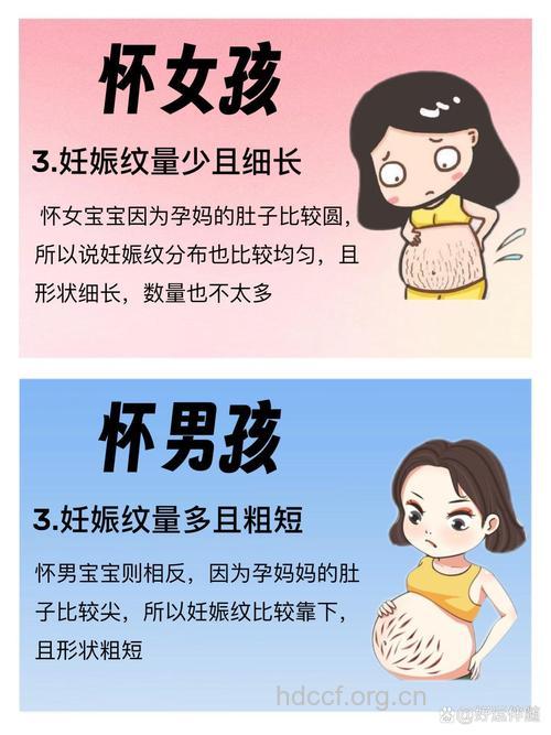 妊娠纹判断生男生女准确吗