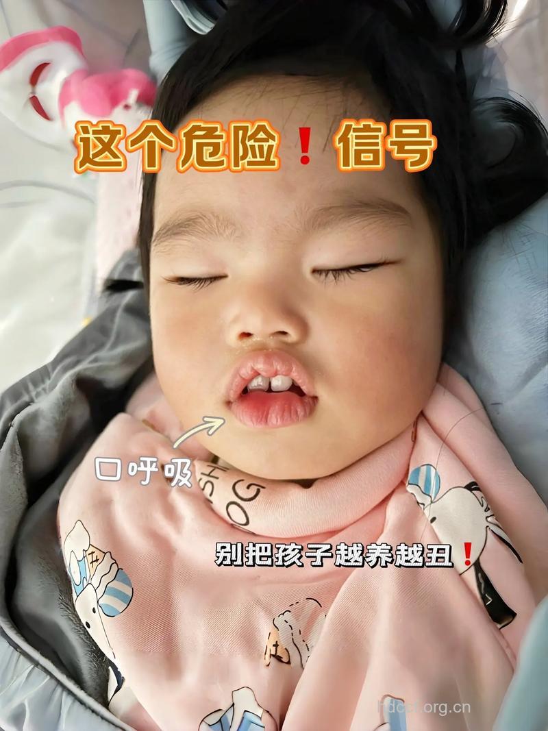 奶嘴过大容易导致新生儿窒息