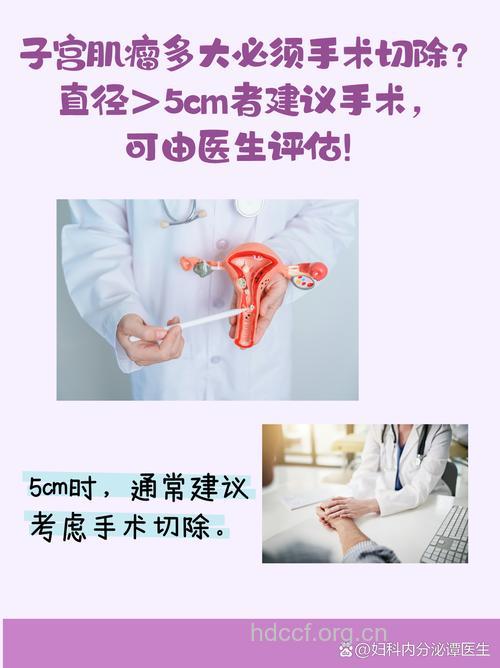 子宫肌瘤多大需要手术