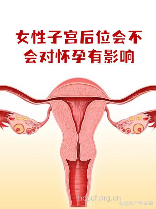 子宫后倾会影响怀孕吗