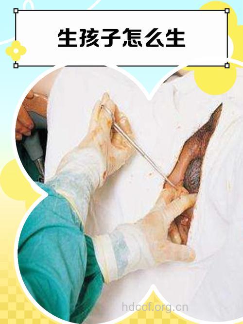 哪种女人容易生男宝宝