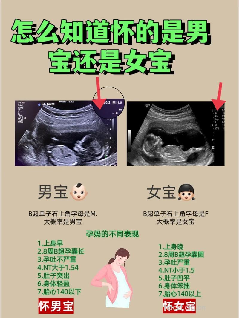 胎儿的性别能提前知道吗