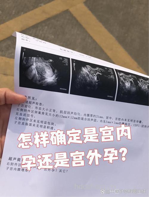 如何判断是否宫外孕？看HCG判断宫外孕