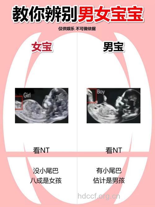 胎梦能判断宝宝性别吗?