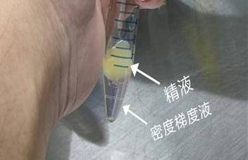 精液从阴道流出还会怀孕吗