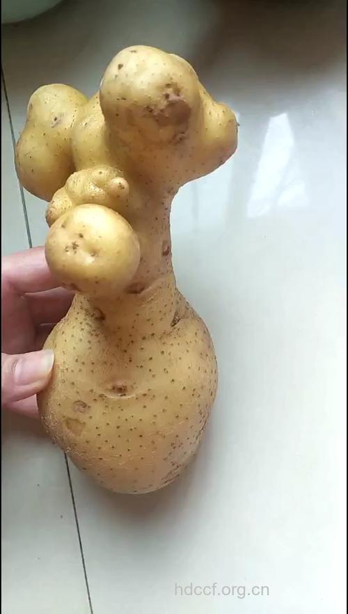 孕妇吃土豆生畸形儿 原因是为何