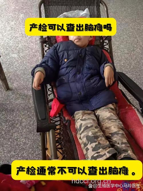 孕妇流产会导致小儿脑瘫吗