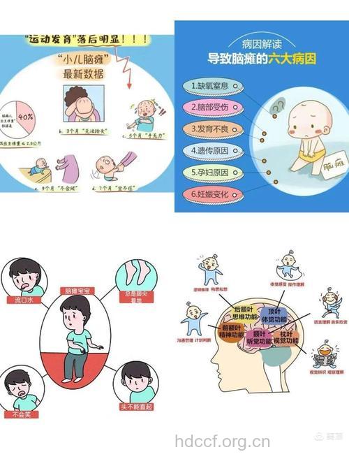 小儿脑瘫是由什么病因引起的