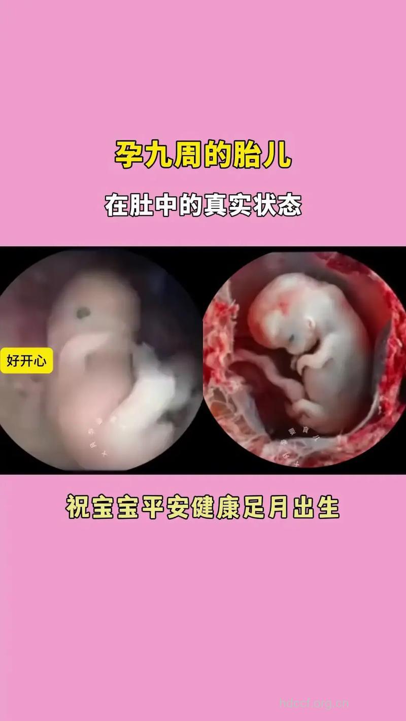 图示胎位 怀孕9周胎儿胎位图