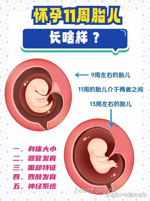图示胎位 怀孕11周胎儿胎位图