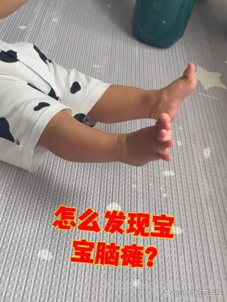 小儿脑瘫症状有什么呢