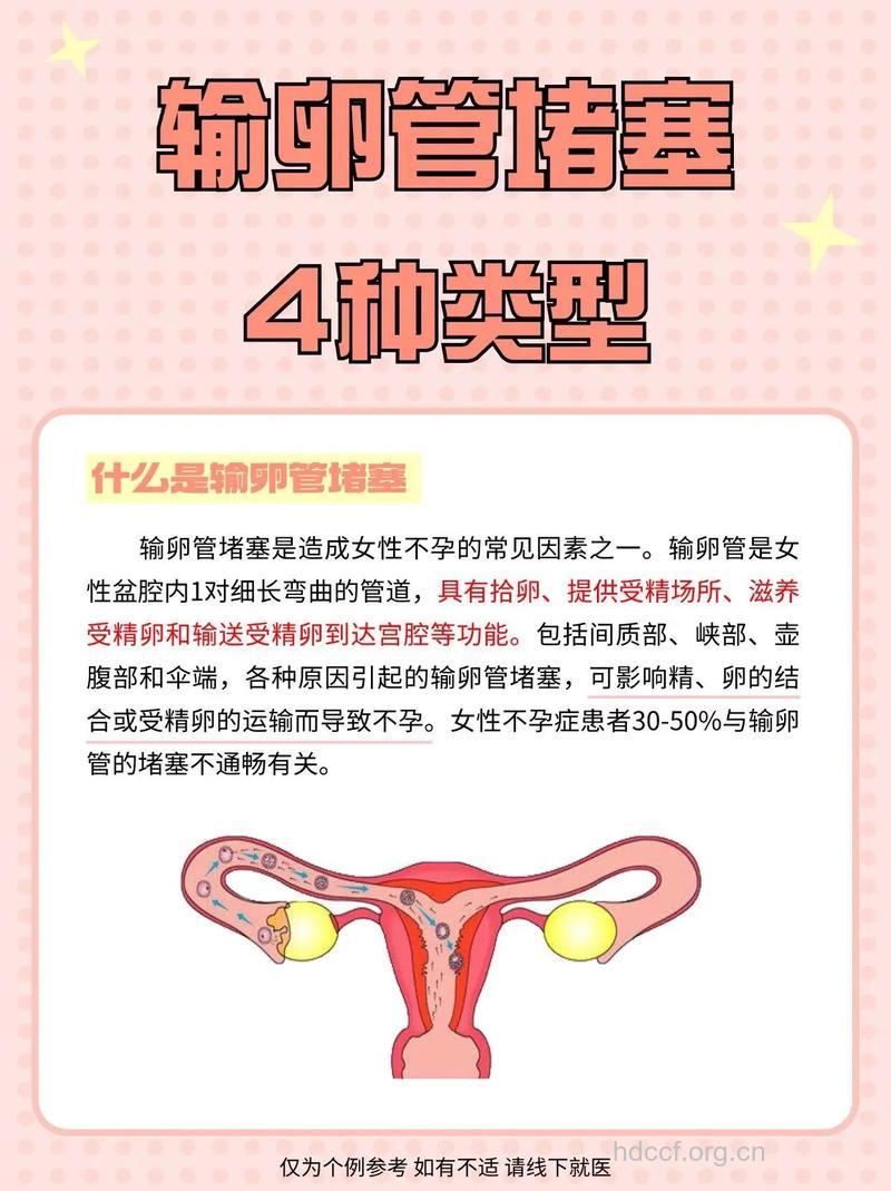 输卵管不通有哪几种？