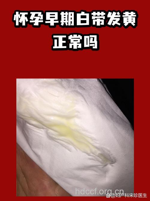 怀孕初期有白带 还有这些变化你知道吗