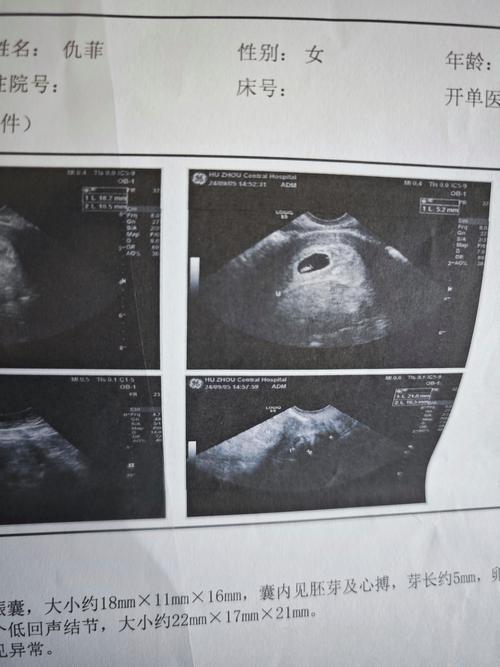 怀孕89天