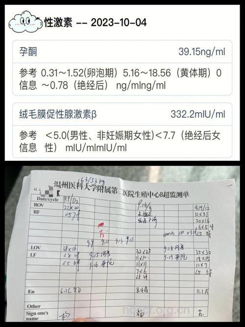 备孕成功经验 备孕四个月好孕经验分享