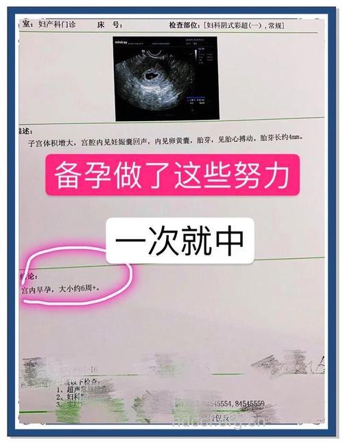 生化当月好孕 网友分享好孕经验