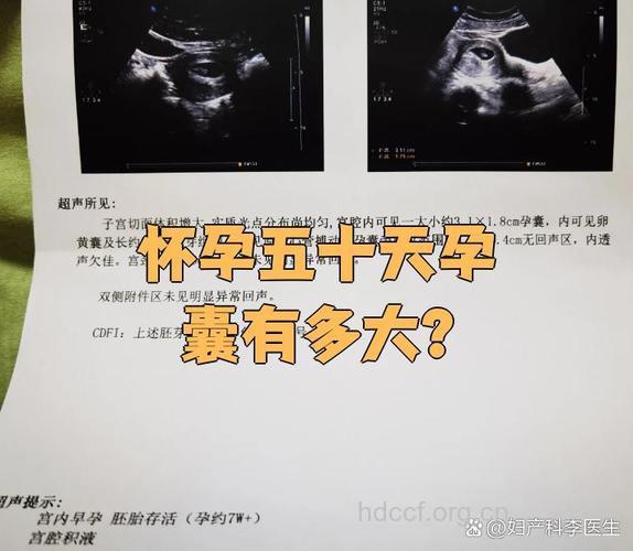 怀孕50天