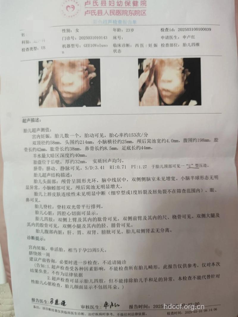四维顺利过 网友孕前月经调理经验分享